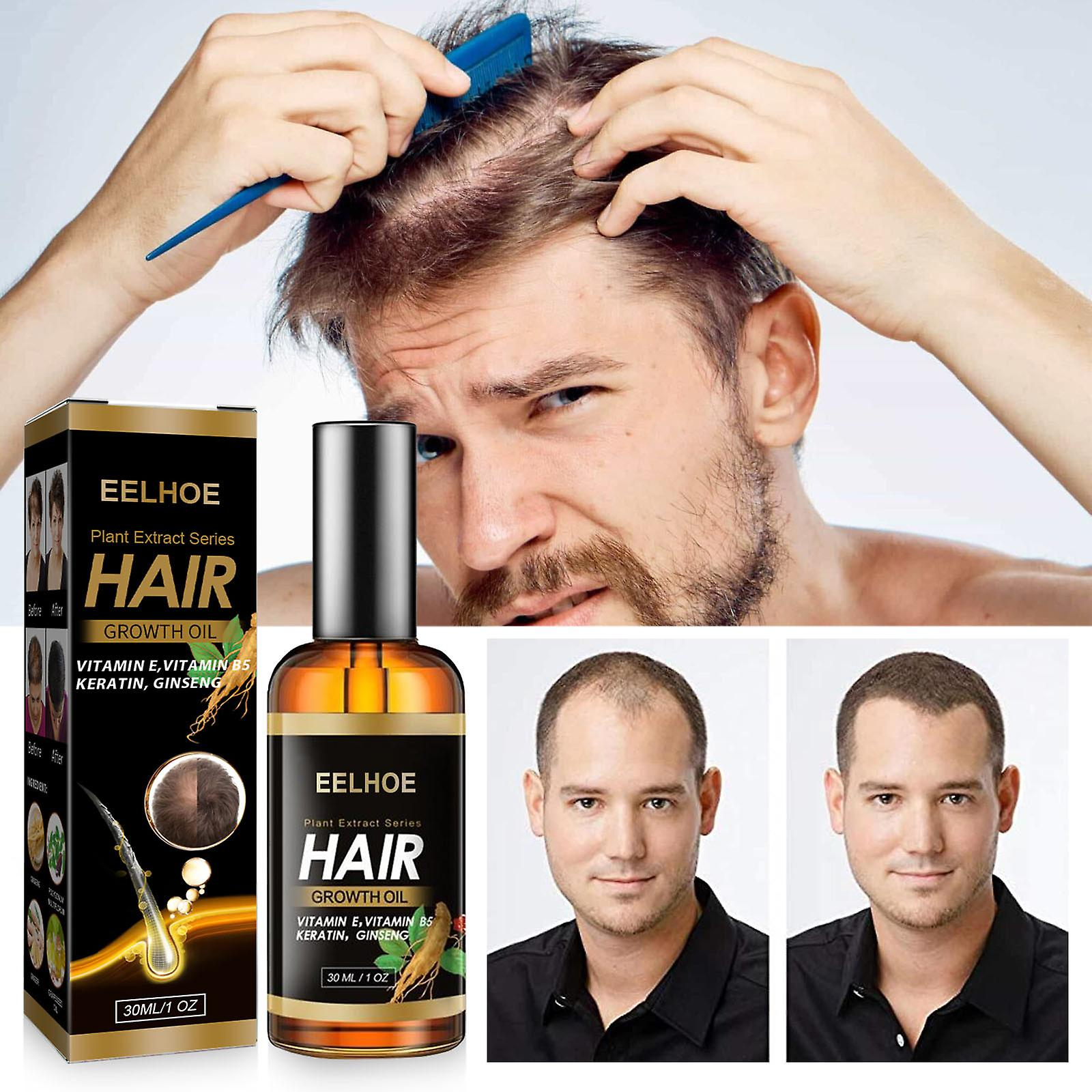 Foto 5 pulgar | El Sérum Para El Crecimiento Del Cabello Huoguo 30 Ml Promueve El Crecimiento Del Cabello Más Grueso - Venta Intern