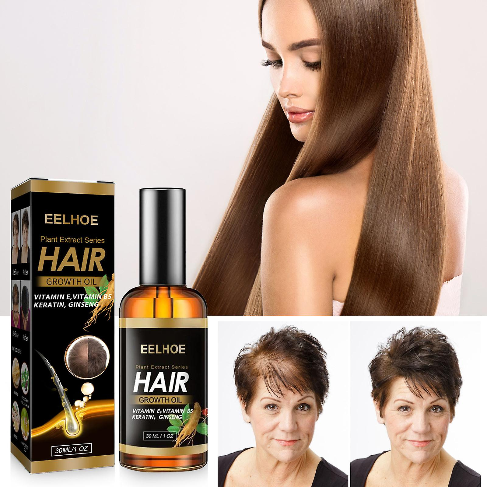 Foto 6 pulgar | El Sérum Para El Crecimiento Del Cabello Huoguo 30 Ml Promueve El Crecimiento Del Cabello Más Grueso - Venta Intern