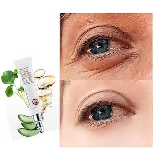 Foto 1 | Crema Para Ojos Huoguo Eliminador De Arrugas Que Hidrata Las Ojeras - Venta Internacional.