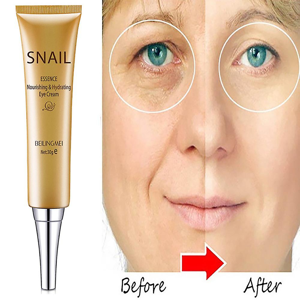 Foto 2 pulgar | Crema De Ojos Huoguo Hidratación Profunda Para Eliminar Arrugas Con Esencia De Caracol - Venta Internacional.