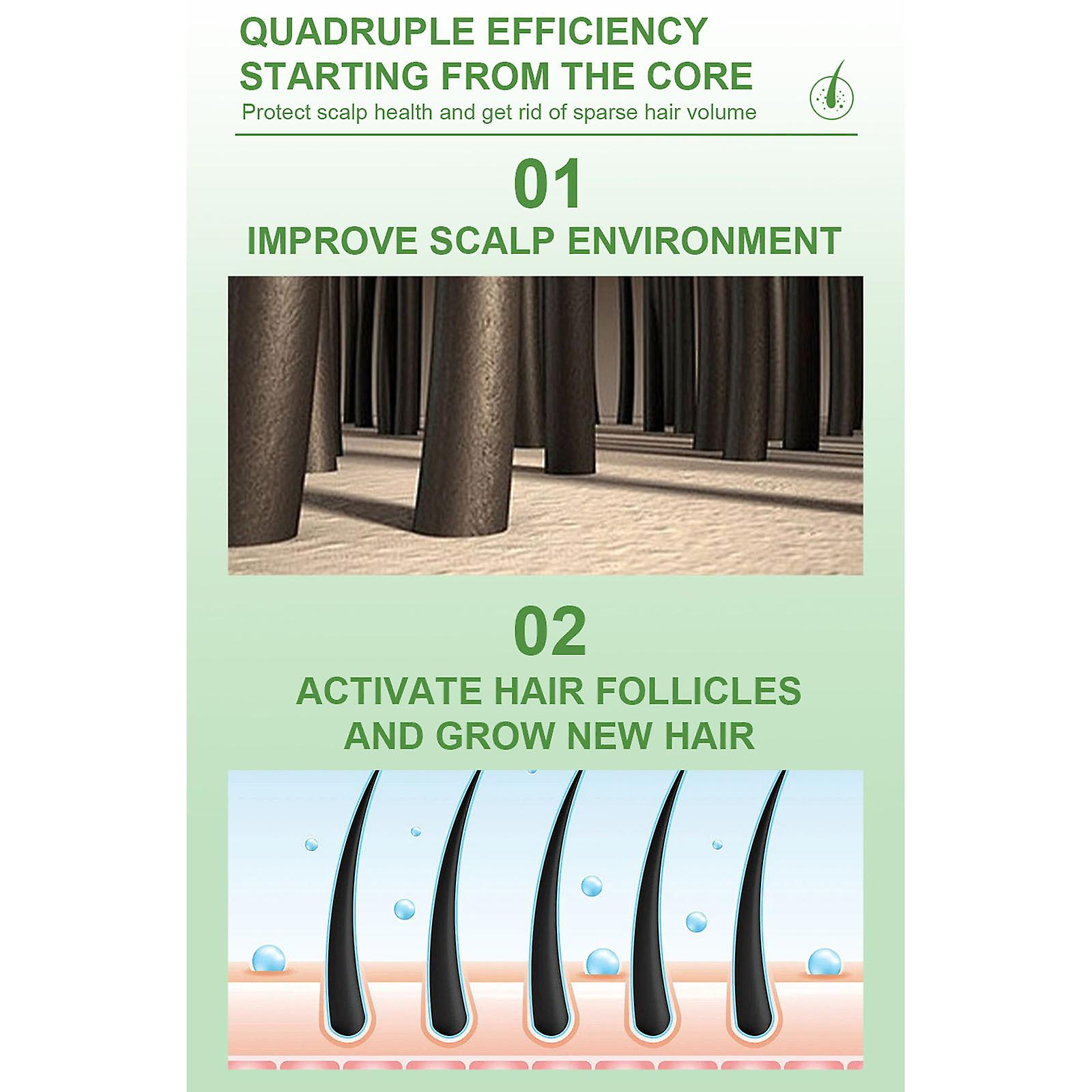 Foto 5 pulgar | Spray Para El Crecimiento Del Cabello Huoguo  Regenerador Y Nutritivo  120 Ml - Venta Internacional.