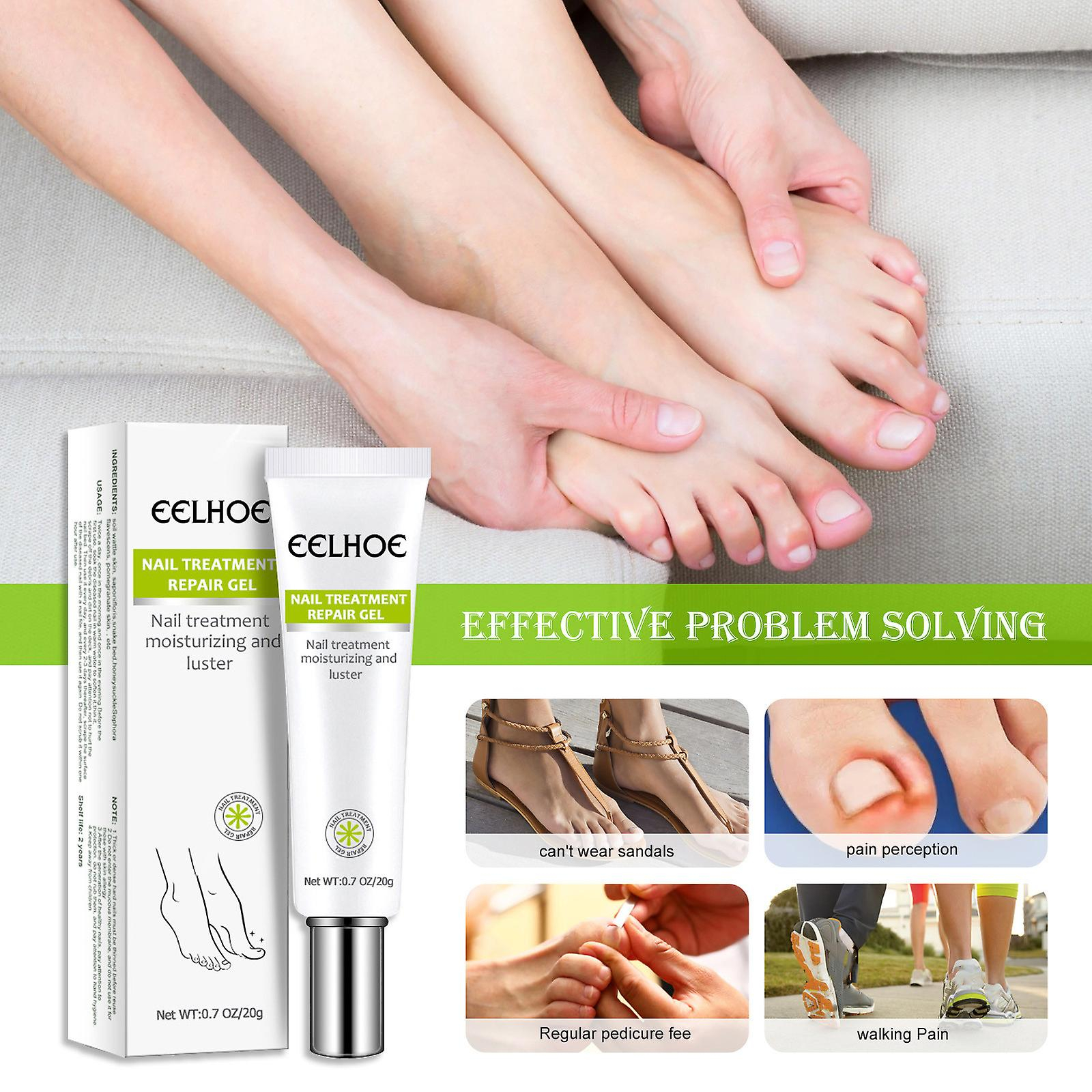Foto 2 pulgar | Gel Reparador De Uñas Huoguo 20 G Para Uñas Infectadas O Agrietadas - Venta Internacional.
