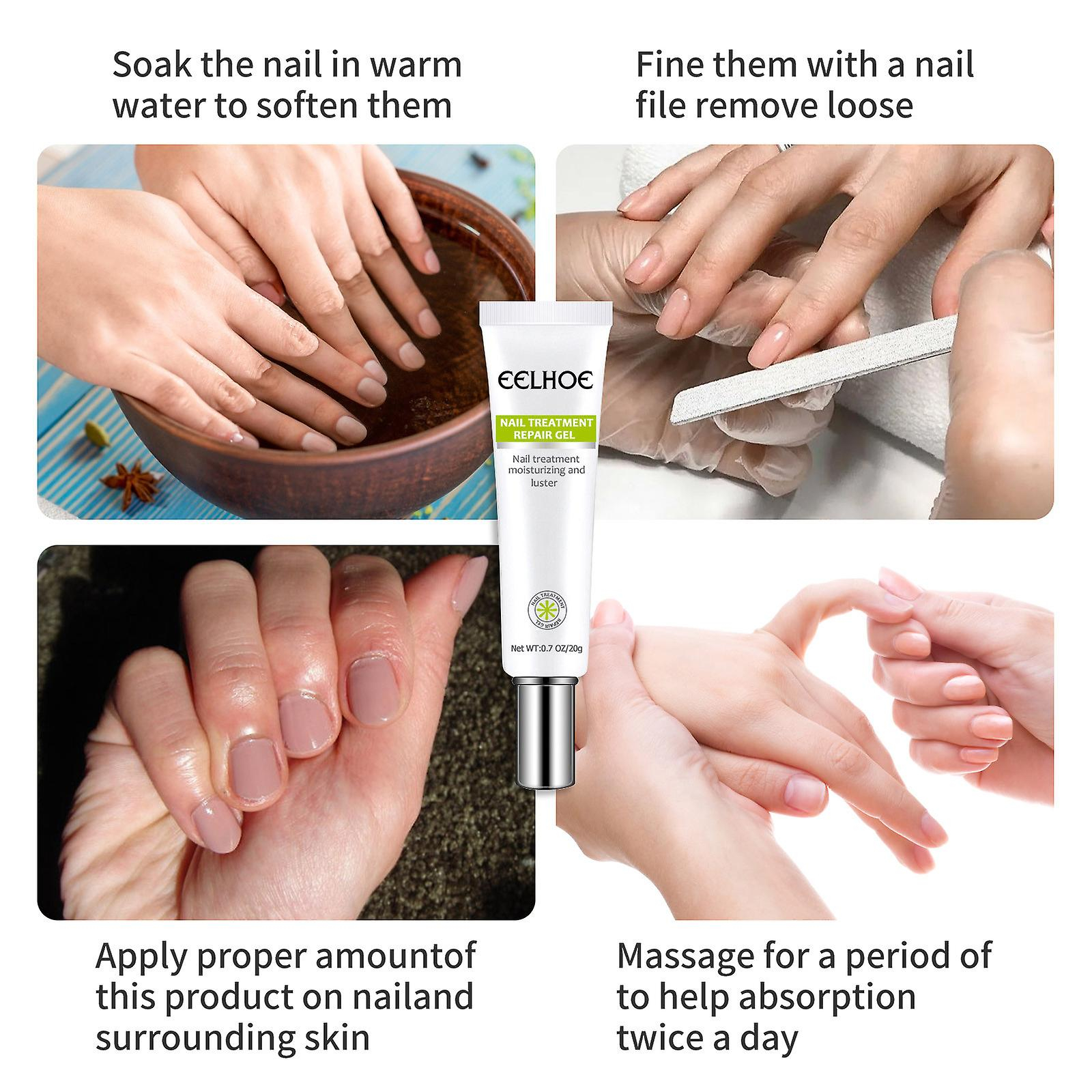 Foto 4 pulgar | Gel Reparador De Uñas Huoguo 20 G Para Uñas Infectadas O Agrietadas - Venta Internacional.