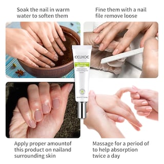 Foto 3 | Gel Reparador De Uñas Huoguo 20 G Para Uñas Infectadas O Agrietadas - Venta Internacional.