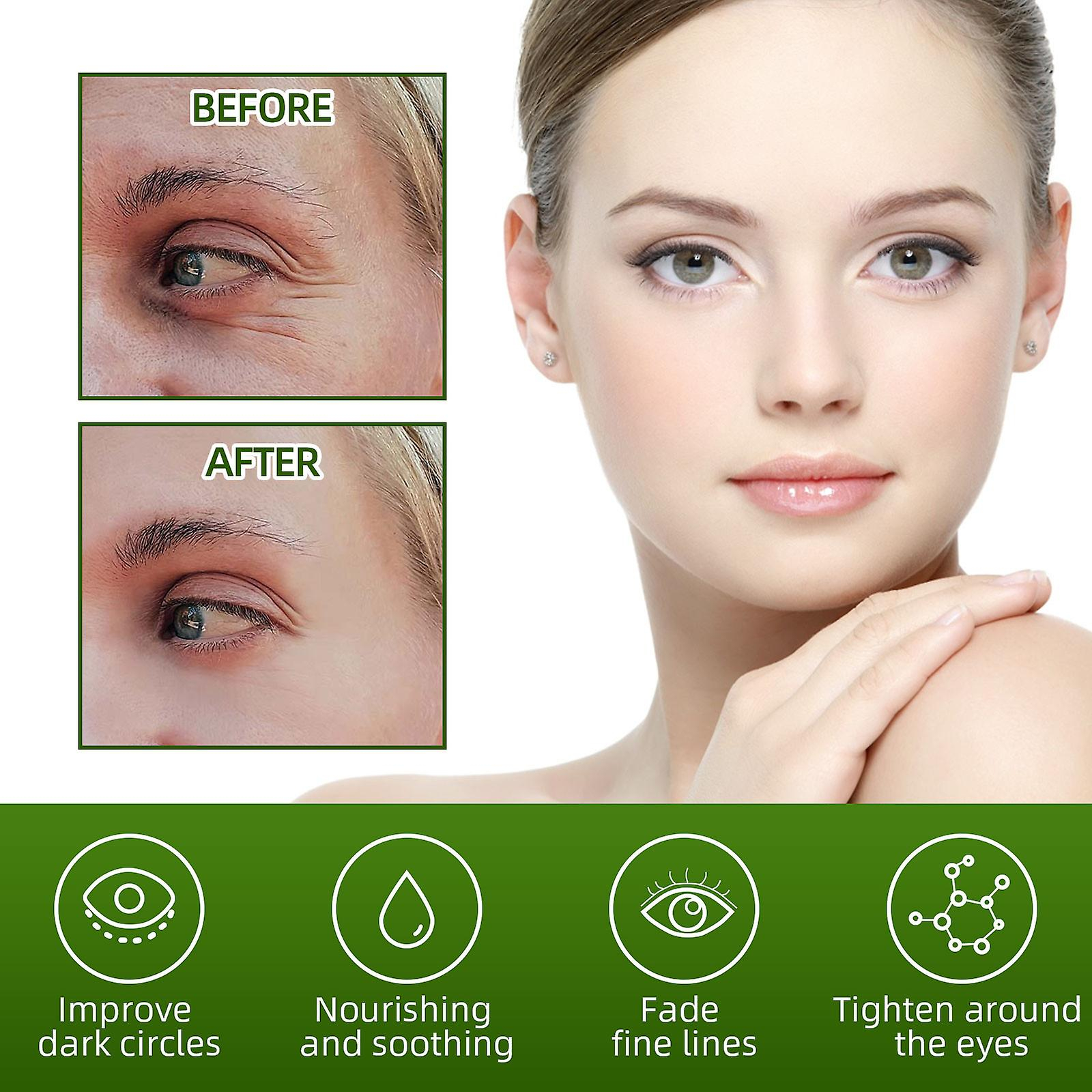 Foto 5 pulgar | Crema De Ojos Huoguo  Reparadora De Ojeras Y Arrugas  Reafirmante  30 G - Venta Internacional.