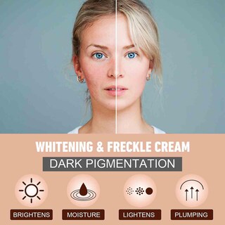 Foto 3 | Crema Blanqueadora Huoguo Para Axilas Codos Y Rodillas Bikini - Venta Internacional.