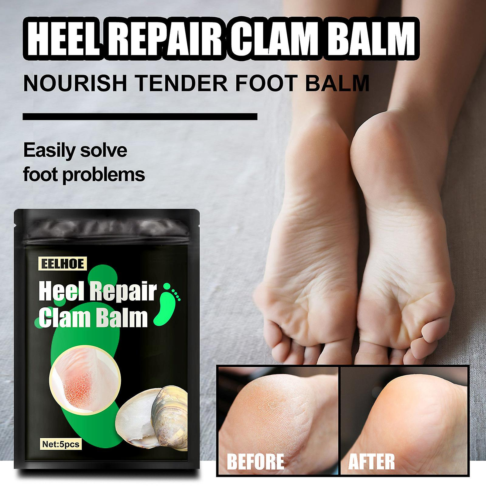 Foto 3 pulgar | La Crema Reparadora De Pies Huoguo Clam Hidrata Y Suaviza La Piel - Venta Internacional.