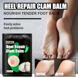 Foto 2 | La Crema Reparadora De Pies Huoguo Clam Hidrata Y Suaviza La Piel - Venta Internacional.