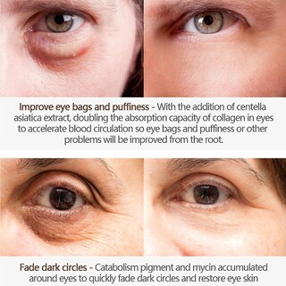 Foto 3 | Crema Para Ojos Huoguo Antiedad Ojeras Hinchazón 15 Ml - Venta Internacional.