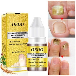 Foto 2 | El Aceite Esencial Para El Cuidado De Las Uñas Huoguo Previene El Crecimiento De Hongos 10 Ml - Venta Internacional.