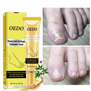 Foto 1 | El Aceite Esencial Para El Cuidado De Las Uñas Huoguo Previene El Crecimiento De Hongos 15 Ml - Venta Internacional.
