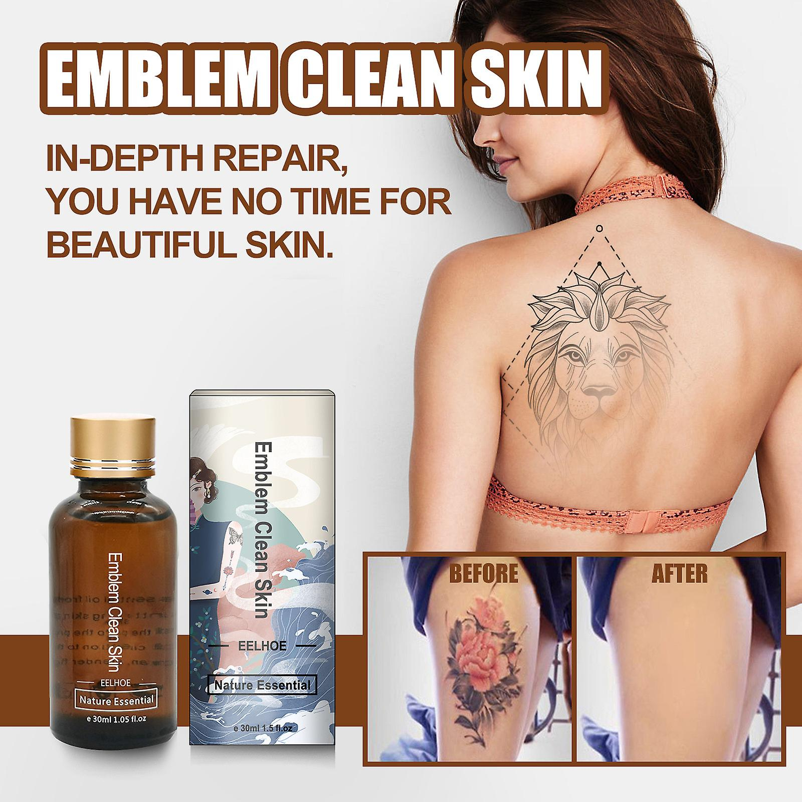 Foto 3 pulgar | El Eliminador De Tatuajes Huoguo 30 Ml Puede Eliminar Tatuajes De Manera Efectiva - Venta Internacional.