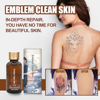 Foto 2 | El Eliminador De Tatuajes Huoguo 30 Ml Puede Eliminar Tatuajes De Manera Efectiva - Venta Internacional.