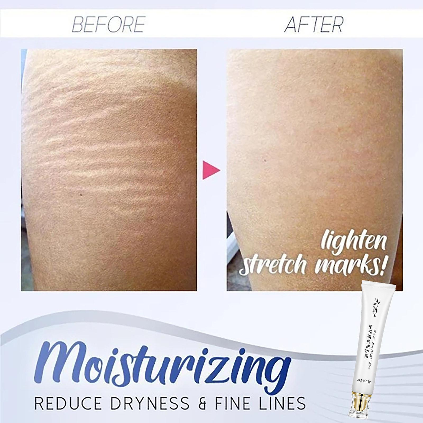 Foto 5 pulgar | Crema Blanqueadora Snowyskin Instant Axarm Armpit 25 Ml - Venta Internacional.