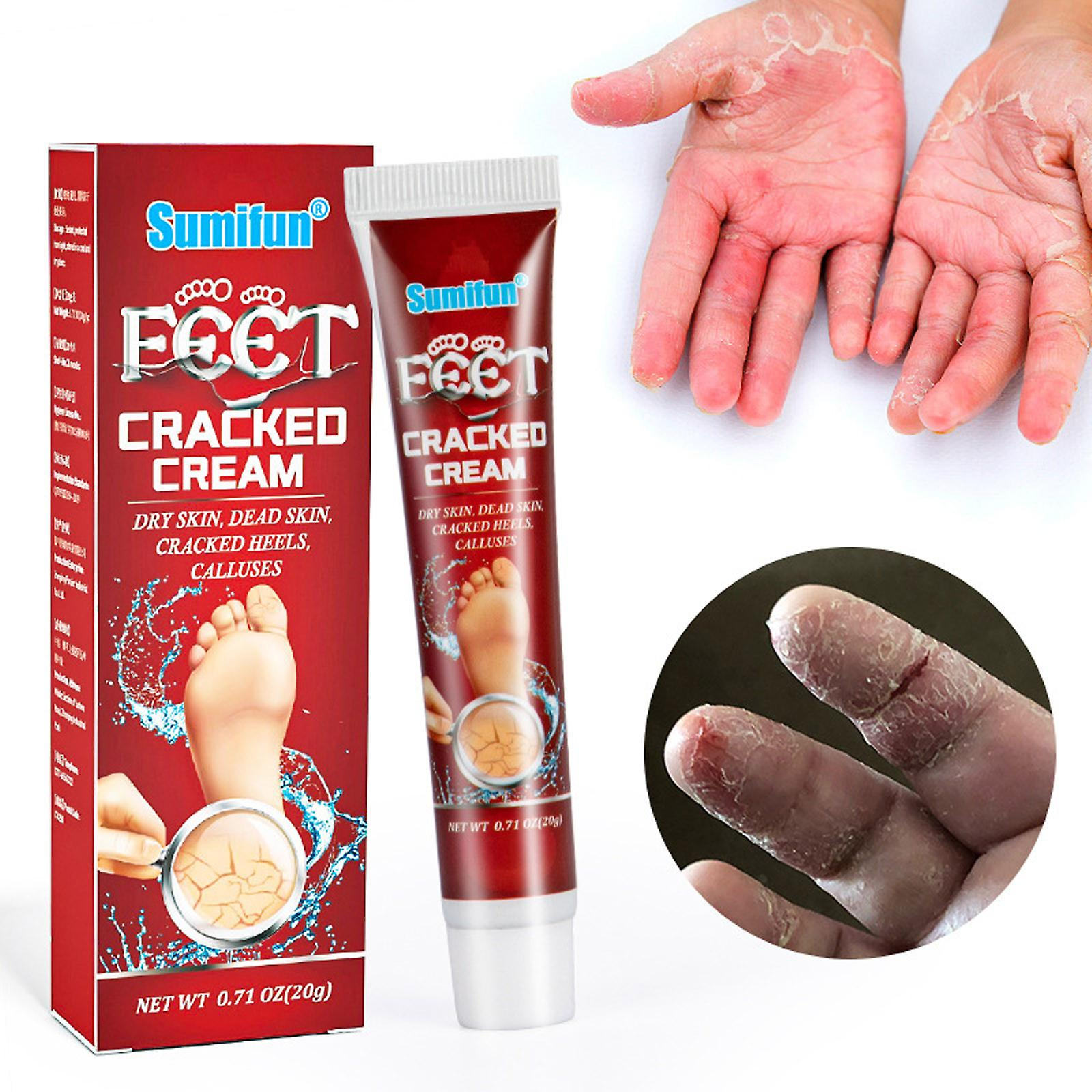 Foto 3 pulgar | Crema Agrietada Para Piel Seca Y Agrietada De Manos Y Pies  20 G - Venta Internacional.