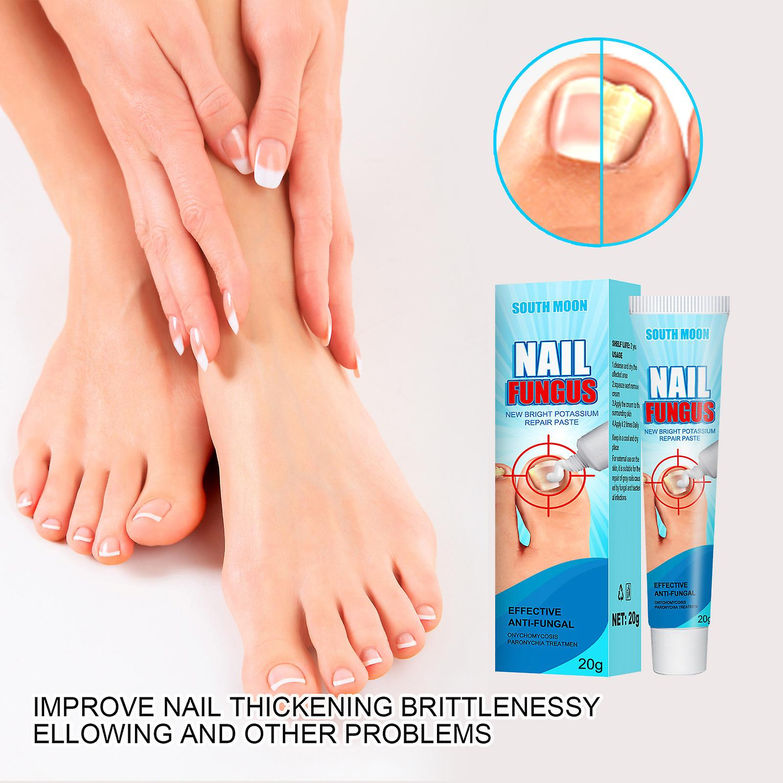Foto 2 | Crema Reparadora De Uñas Huoguo  Onicomicosis  Exfoliación Suave De Uñas - Venta Internacional.
