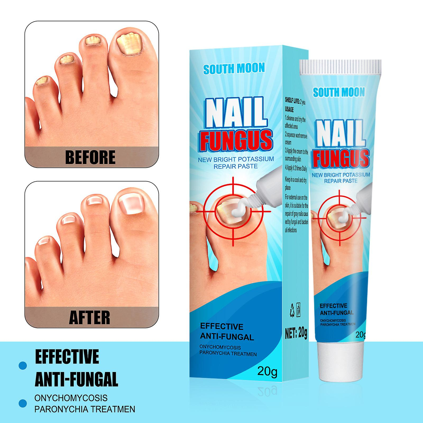 Foto 4 | Crema Reparadora De Uñas Huoguo  Onicomicosis  Exfoliación Suave De Uñas - Venta Internacional.