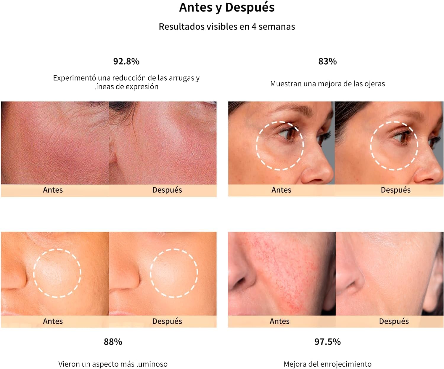 Foto 3 pulgar | Máscara Facial Luz Láser 4d