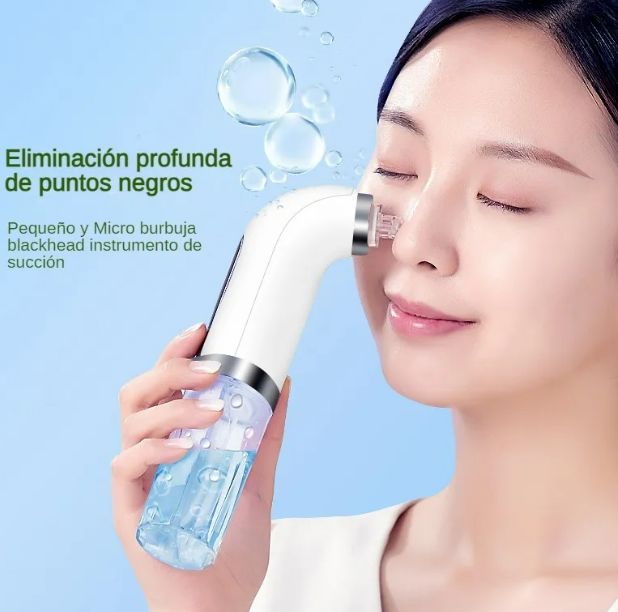 Foto 3 | Xtellar Limpiador Facial Premium Con Tecnología Usb Para Eliminación De Espinillas Y Acné