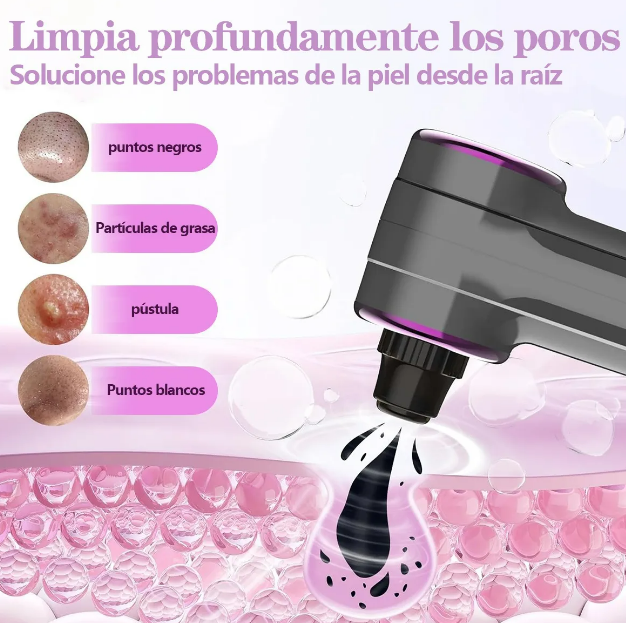 Foto 4 pulgar | Xtellar  Set De Extractor De Espinillas 5 En 1  Disfruta De Una Experiencia Profesional De Limpieza Facial