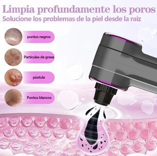 Foto 3 | Xtellar Set De Extractor De Espinillas 5 En 1 Disfruta De Una Experiencia Profesional De Limpieza Facial