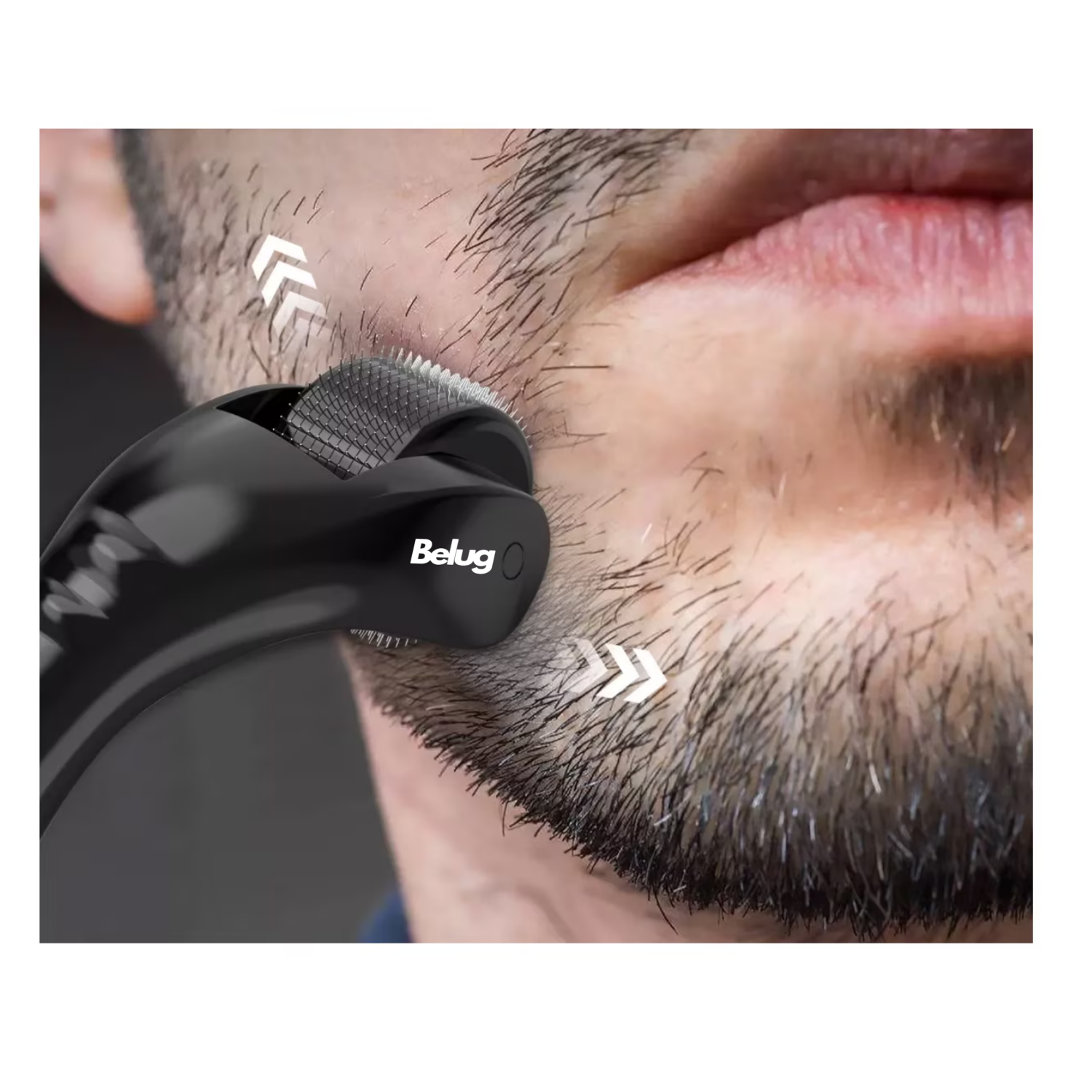 Foto 4 pulgar | Derma Roller Belug 0.5 Mm Para Barba Y Facial Cabello Negr
