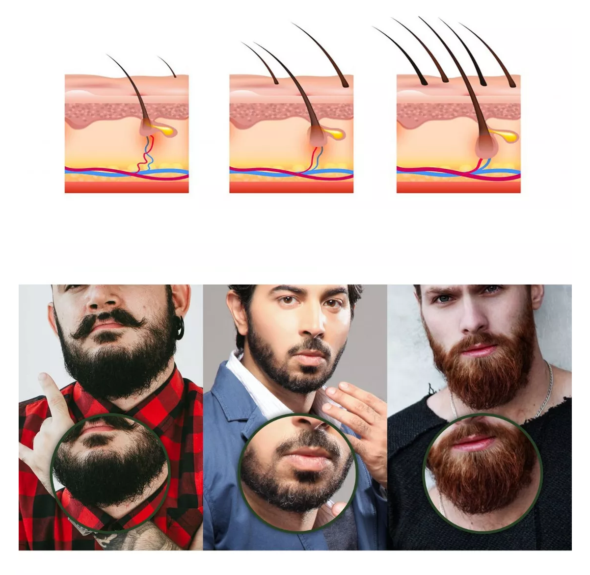 Foto 5 pulgar | Derma Roller Belug 0.5 Mm Para Barba Y Facial Cabello Negr