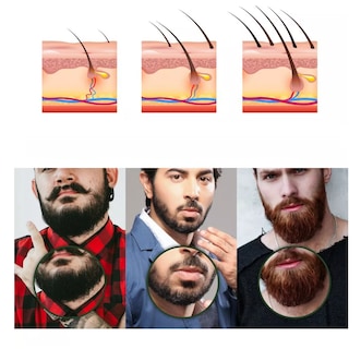Foto 2 | Derma Roller 0.5 Mm Para Barba, Facial Y Cabello, Negro