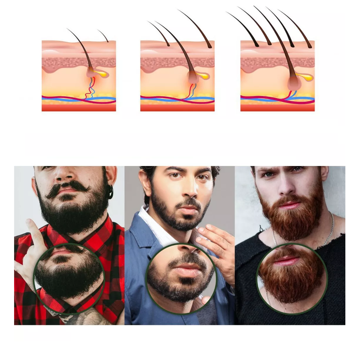 Foto 3 pulgar | Derma Roller 0.5 Mm Para Barba, Facial Y Cabello, Negro
