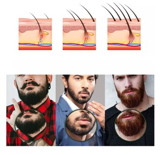 Foto 2 | Derma Roller 0.5 Mm Para Barba, Facial Y Cabello, Negro