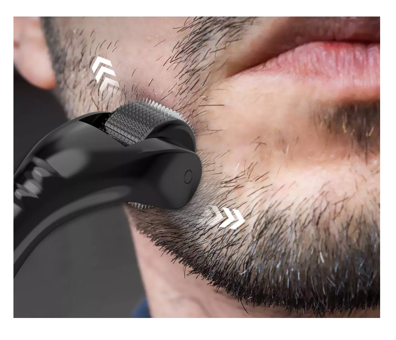 Foto 5 | Derma Roller 0.5 Mm Para Barba, Facial Y Cabello, Negro
