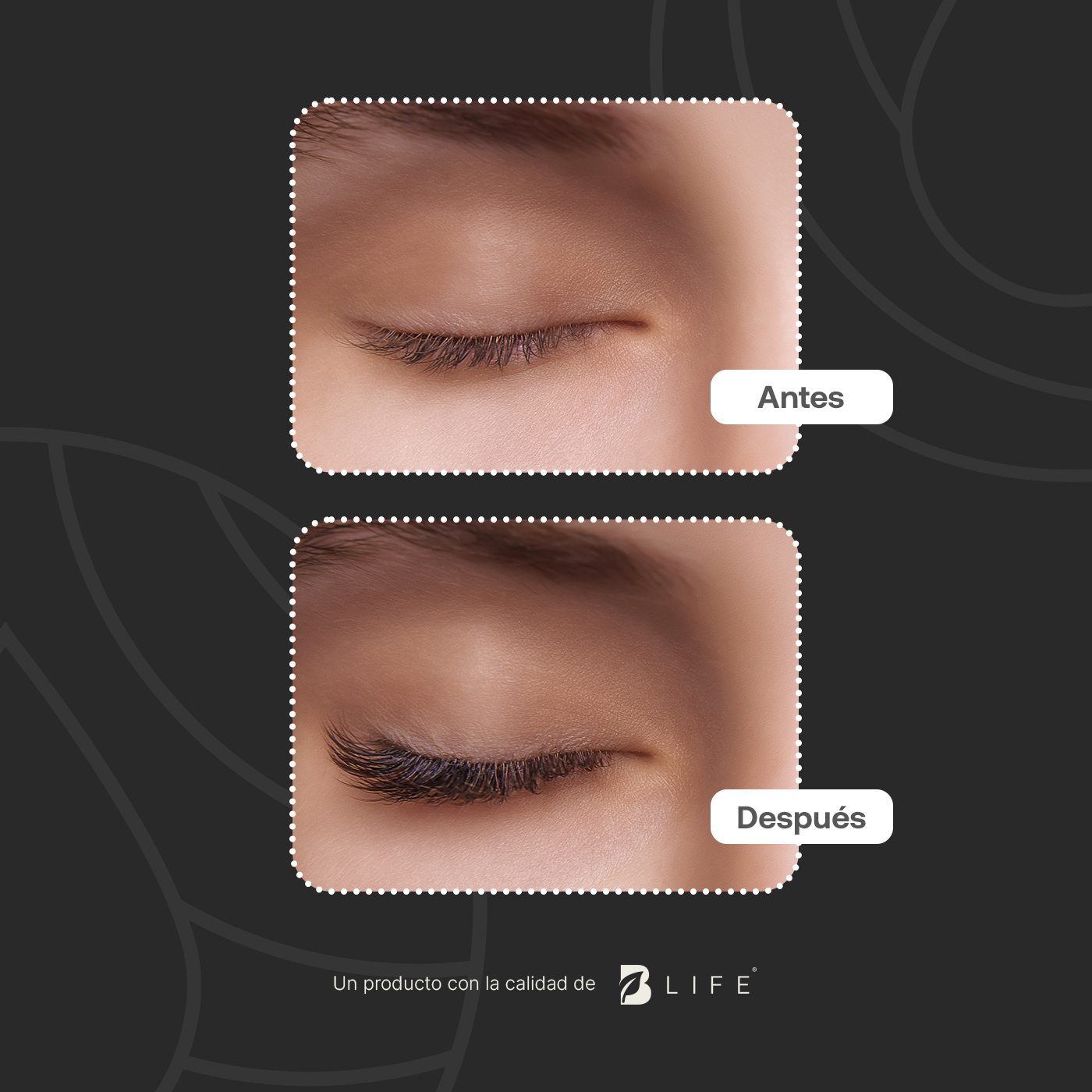 Foto 4 | Aceite De Ricino Natural De 120 Ml Para Pestañas, Cejas Y Cabello. Natural Castor Oil B Life.