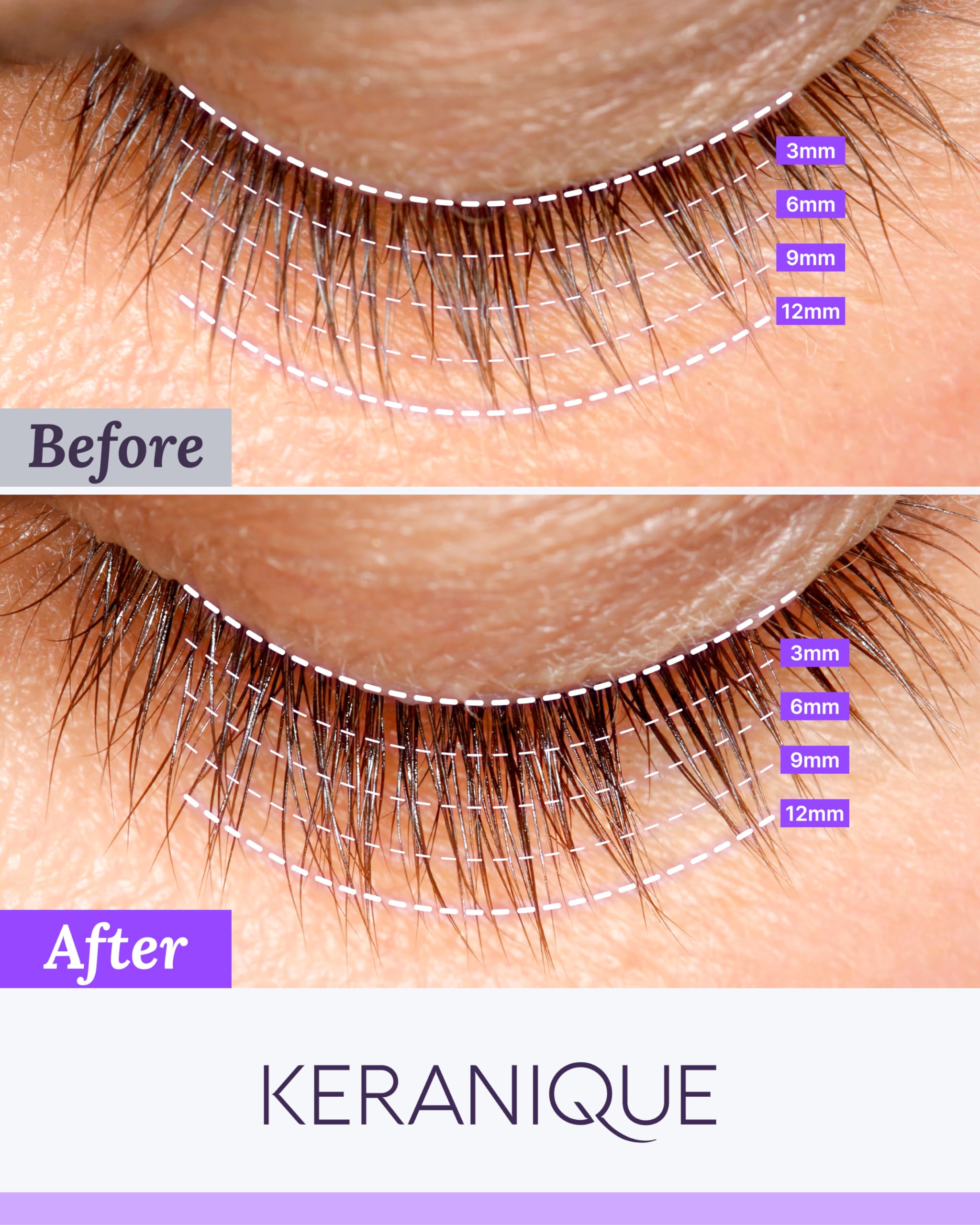 Foto 4 pulgar | Sérum Para El Crecimiento De Pestañas Keranique Lash Serum Para Mujer - Venta Internacional.
