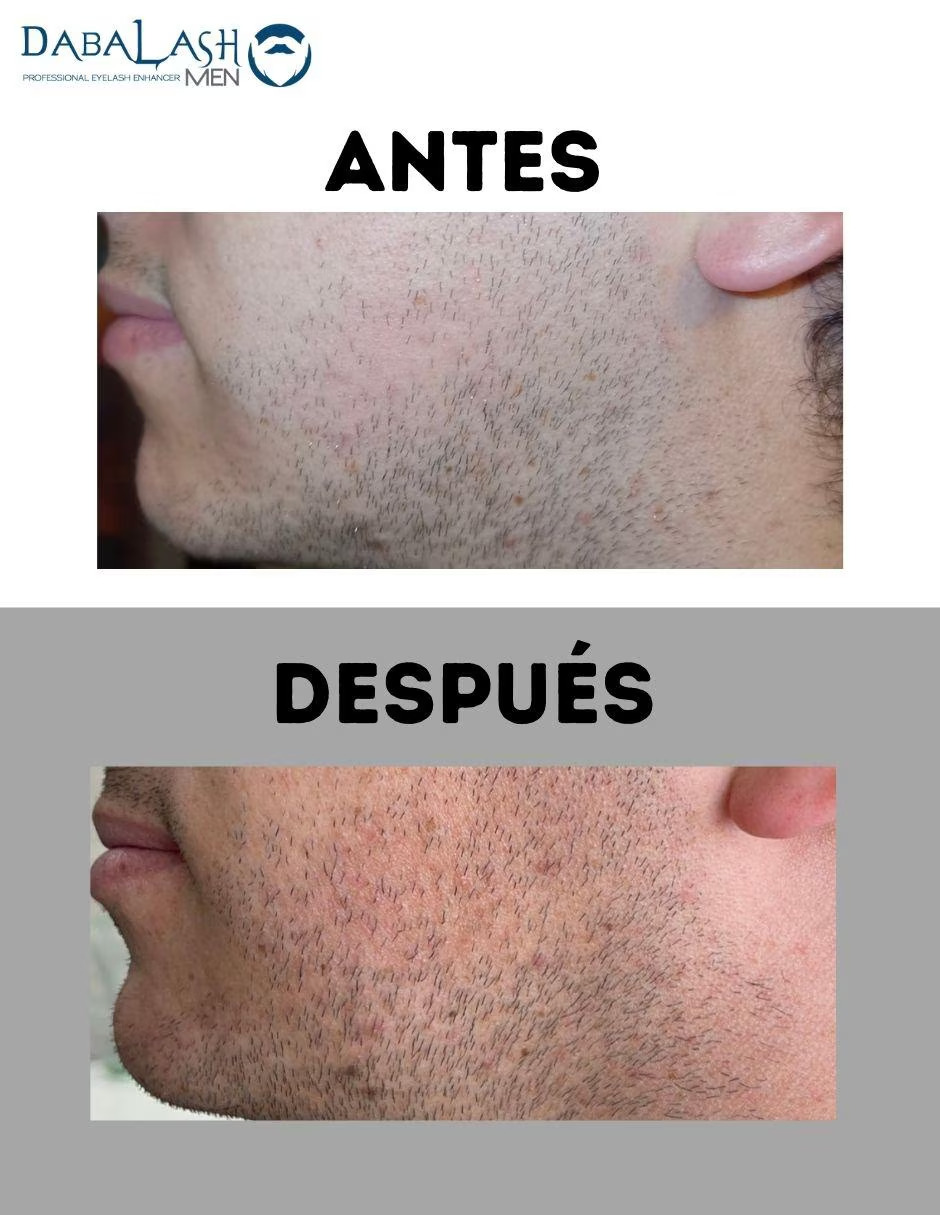 Foto 4 pulgar | Suero Para Pestañas, Cejas Y Barba Dabalash Men De 5.32 Ml