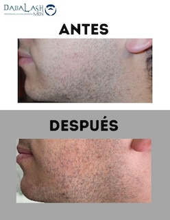 Foto 3 | Suero Para Pestañas, Cejas Y Barba Dabalash Men De 5.32 Ml