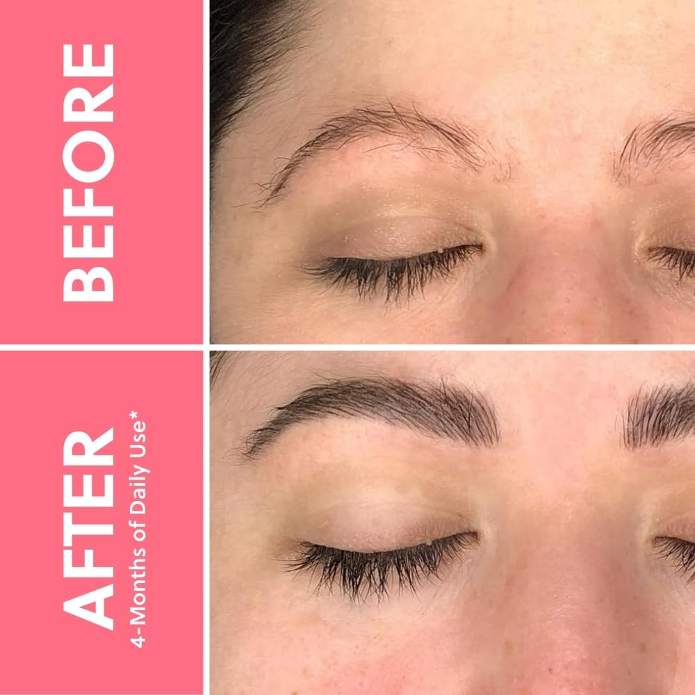 Foto 3 | Sérum Realzador De Cejas Forbrow De Forchics, Paquete De 3 - Venta Internacional.