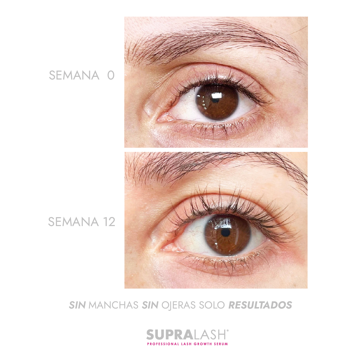 Foto 9 pulgar | Serum Para Crecimiento De Pestañas 2.9 Ml Supralash
