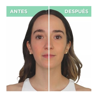 Foto 5 | Base de Maquillaje BB Cream L'oréal Paris Magic Anti-redness 30 ml