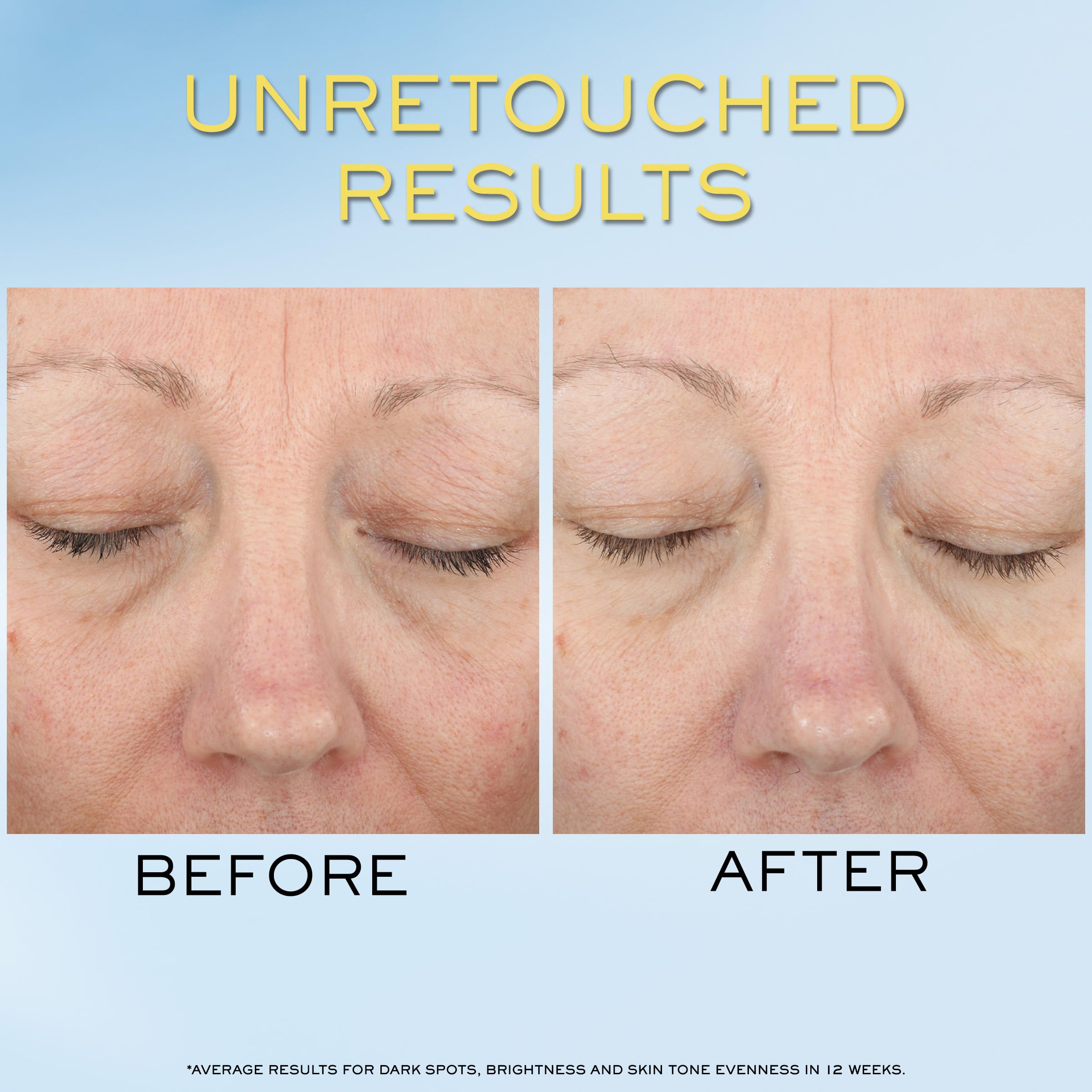Foto 5 pulgar | Crema Solar Supra Screen Invisible Serum De Lancôme, Spf 50+, 30 Ml - Venta Internacional.