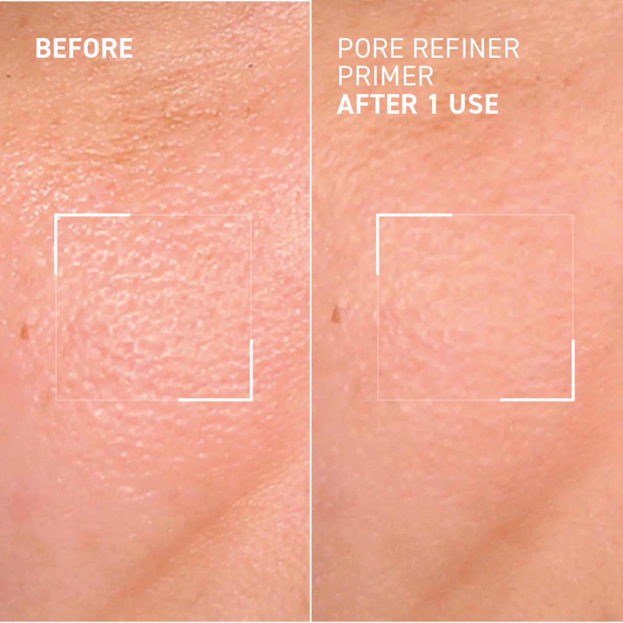 Foto 7 pulgar | Refinador De Poros Primer Dr. Brandt Pores No More, 15 Ml - Venta Internacional.