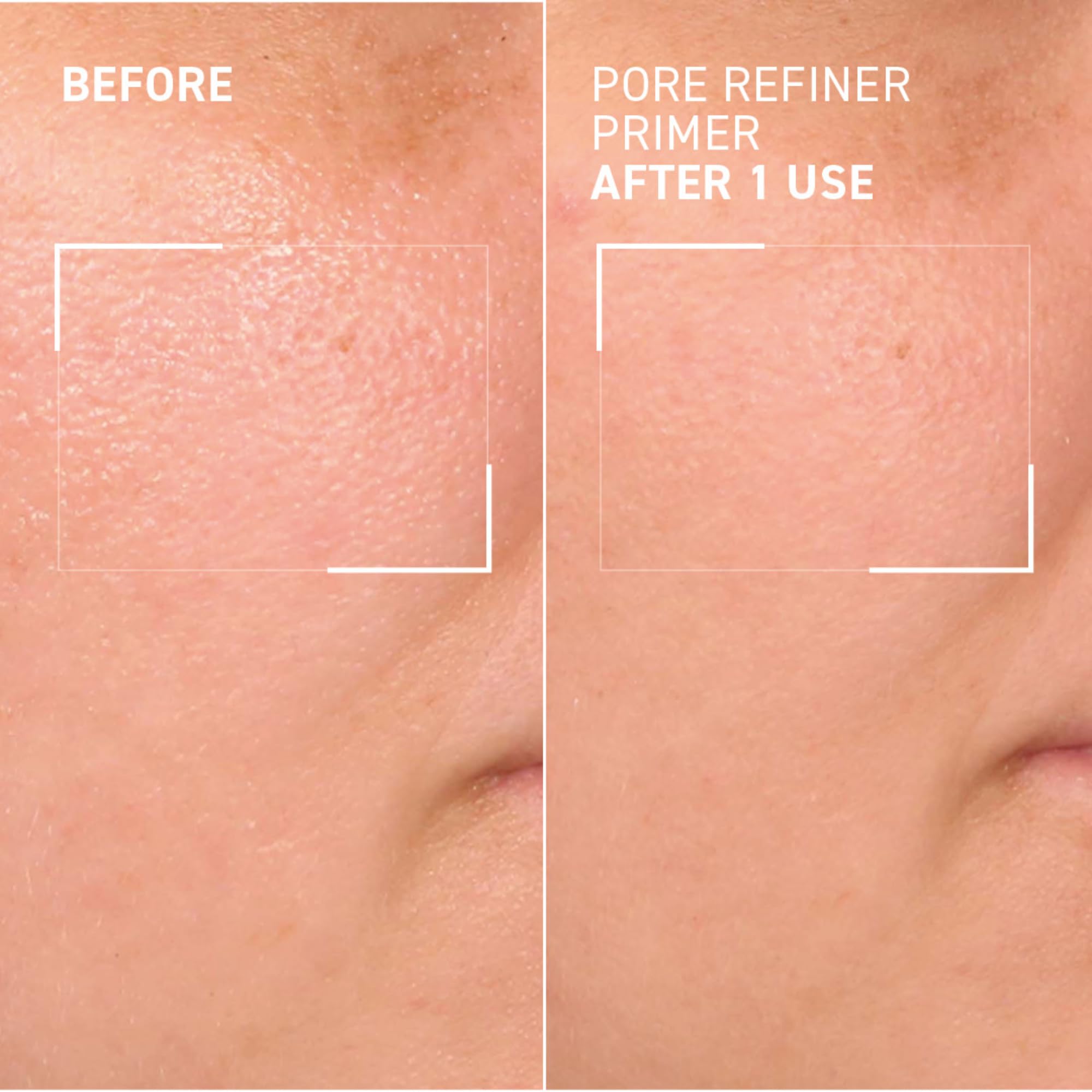Foto 8 pulgar | Refinador De Poros Primer Dr. Brandt Pores No More, 15 Ml - Venta Internacional.