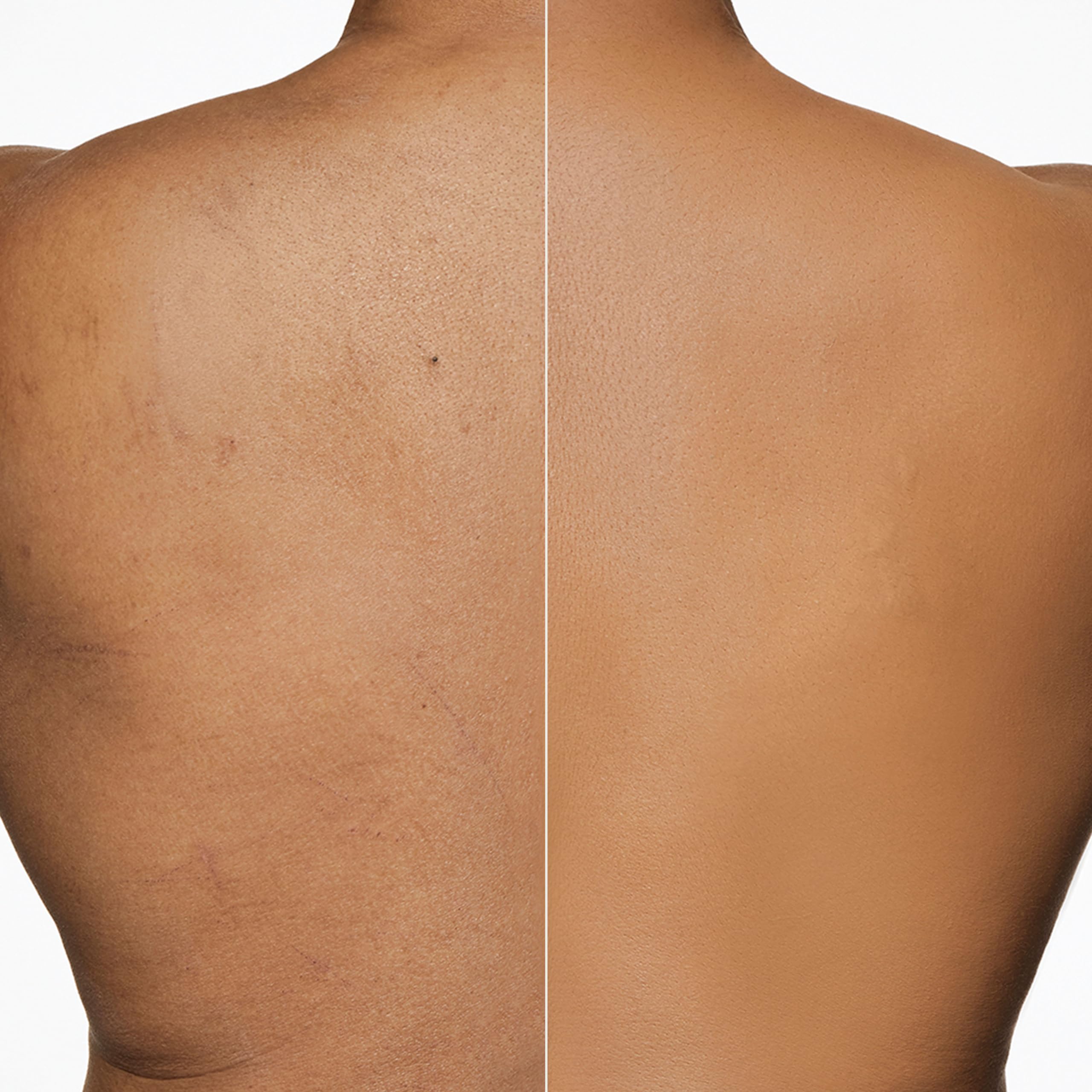 Foto 3 pulgar | Maquillaje Para Piernas Y Cuerpo Foundation Dermablend Con Spf 28 - Venta Internacional.