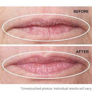 Foto 5 | Tratamiento Strivectin Antiarrugas Double Fix Para Labios - Venta Internacional.