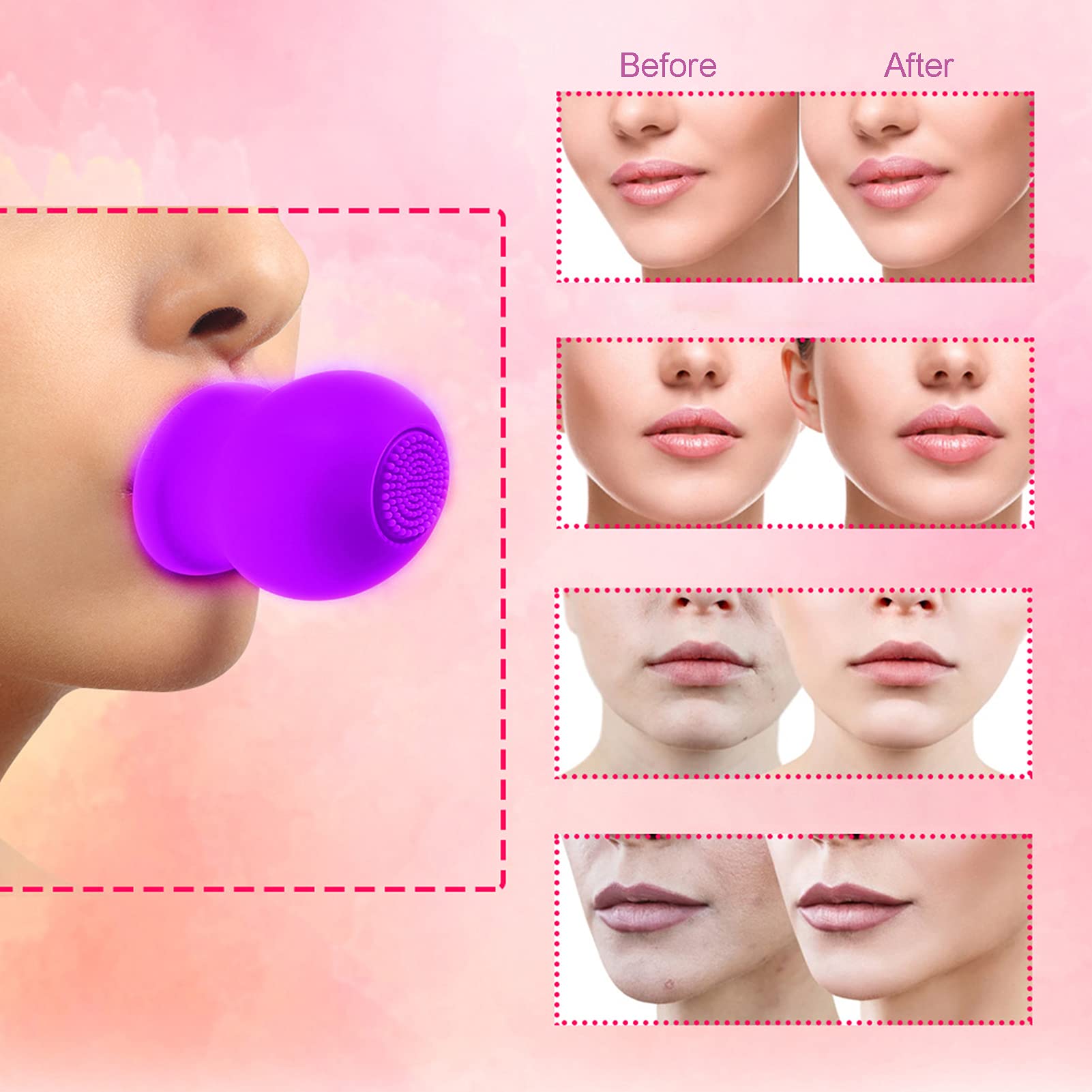 Foto 2 | Lip Plumper Device Zjchao, Bomba De Silicona Para Labios Con Cepillo, Color Morado - Venta Internacional.