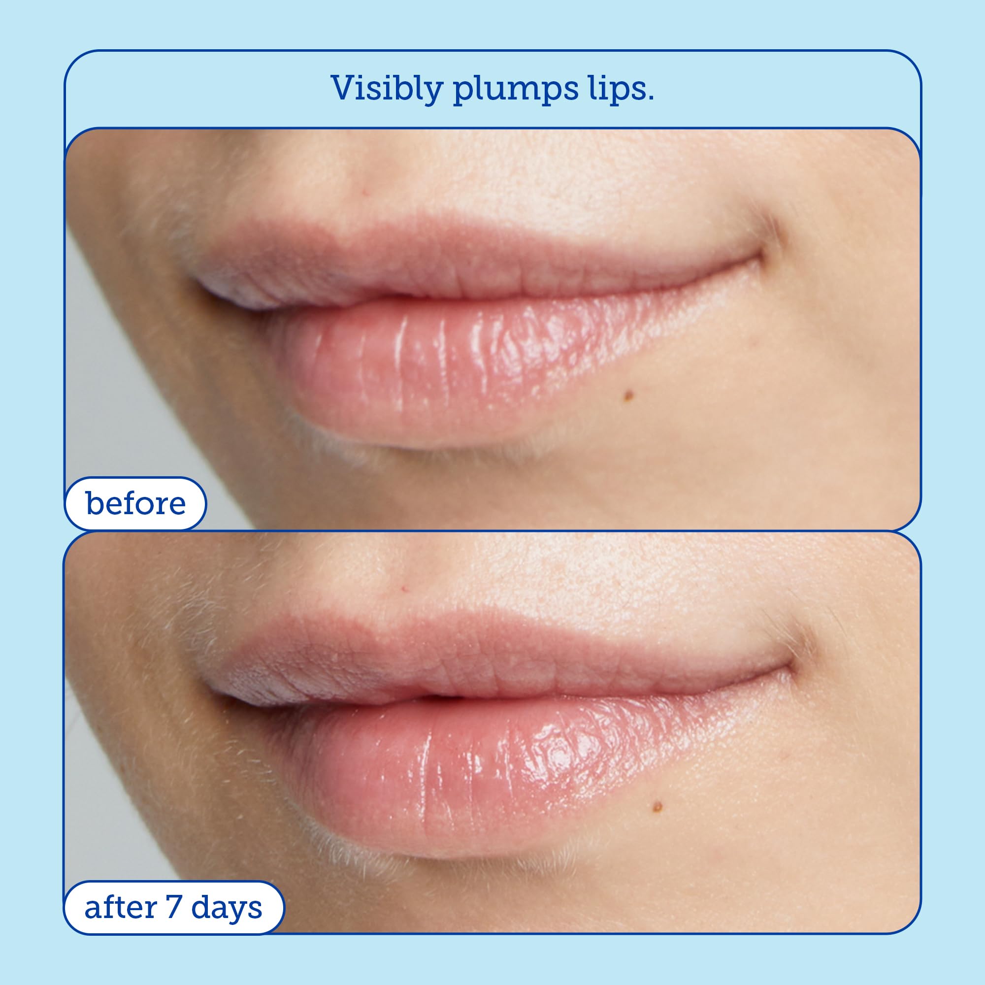Foto 5 pulgar | Tratamiento Labial Skinfix Barrier+ Triple Lipid 8 Ml - Venta Internacional.
