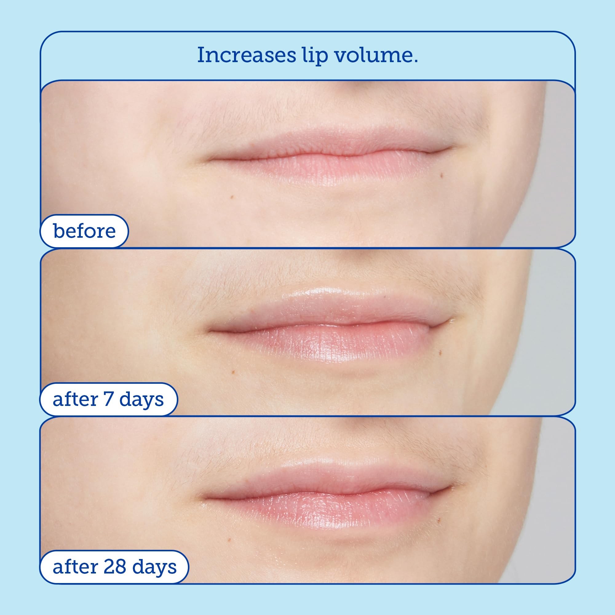 Foto 6 pulgar | Tratamiento Labial Skinfix Barrier+ Triple Lipid 8 Ml - Venta Internacional.