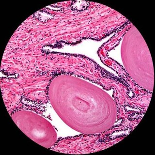 Foto 7 | Cámara Digital Microscópica Amscope Mu130 1.3mp Usb2 - Venta Internacional.