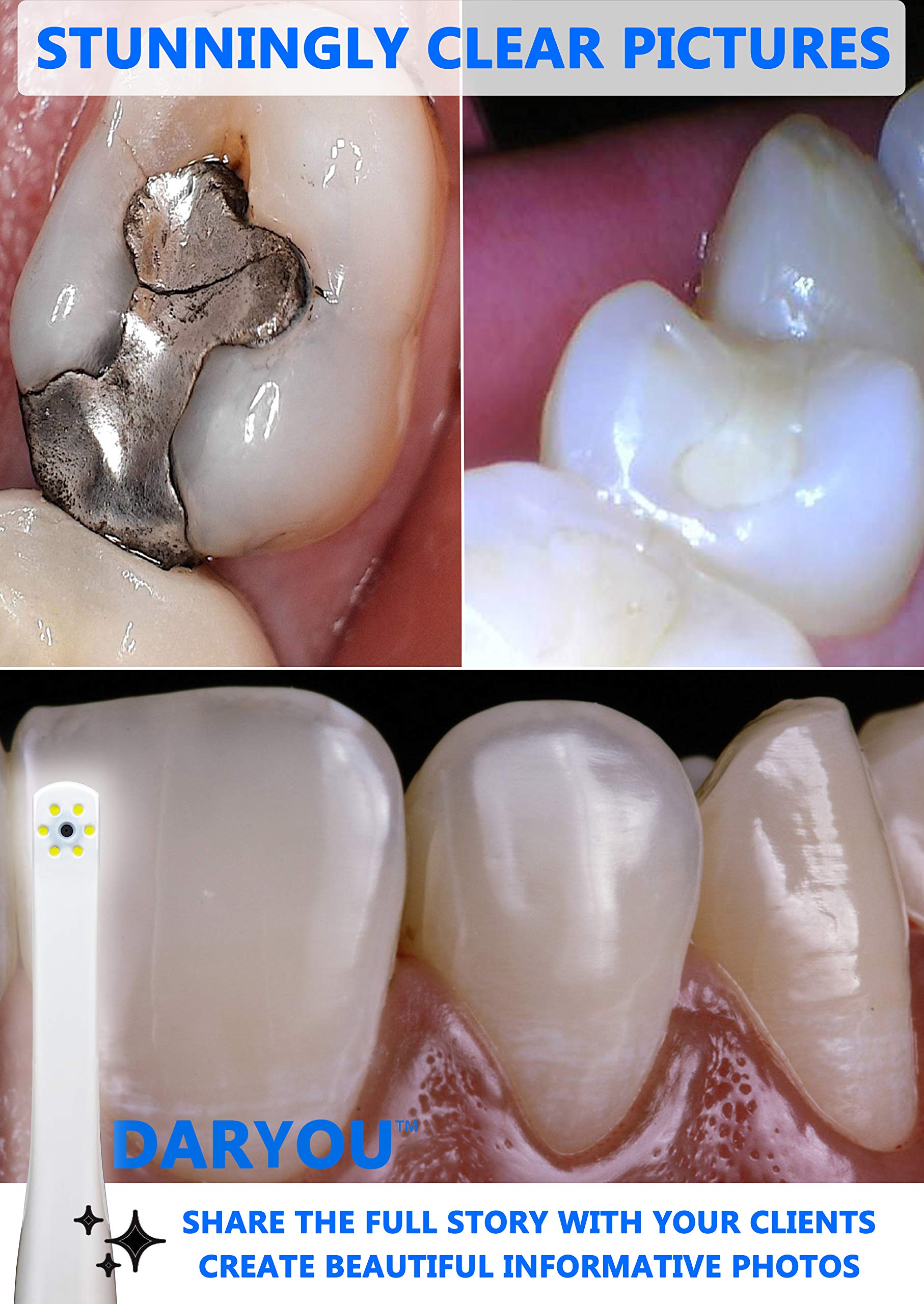 Foto 3 pulgar | Cámara Intraoral Daryou Dy-50 Super Clear Con Controlador - Venta Internacional.