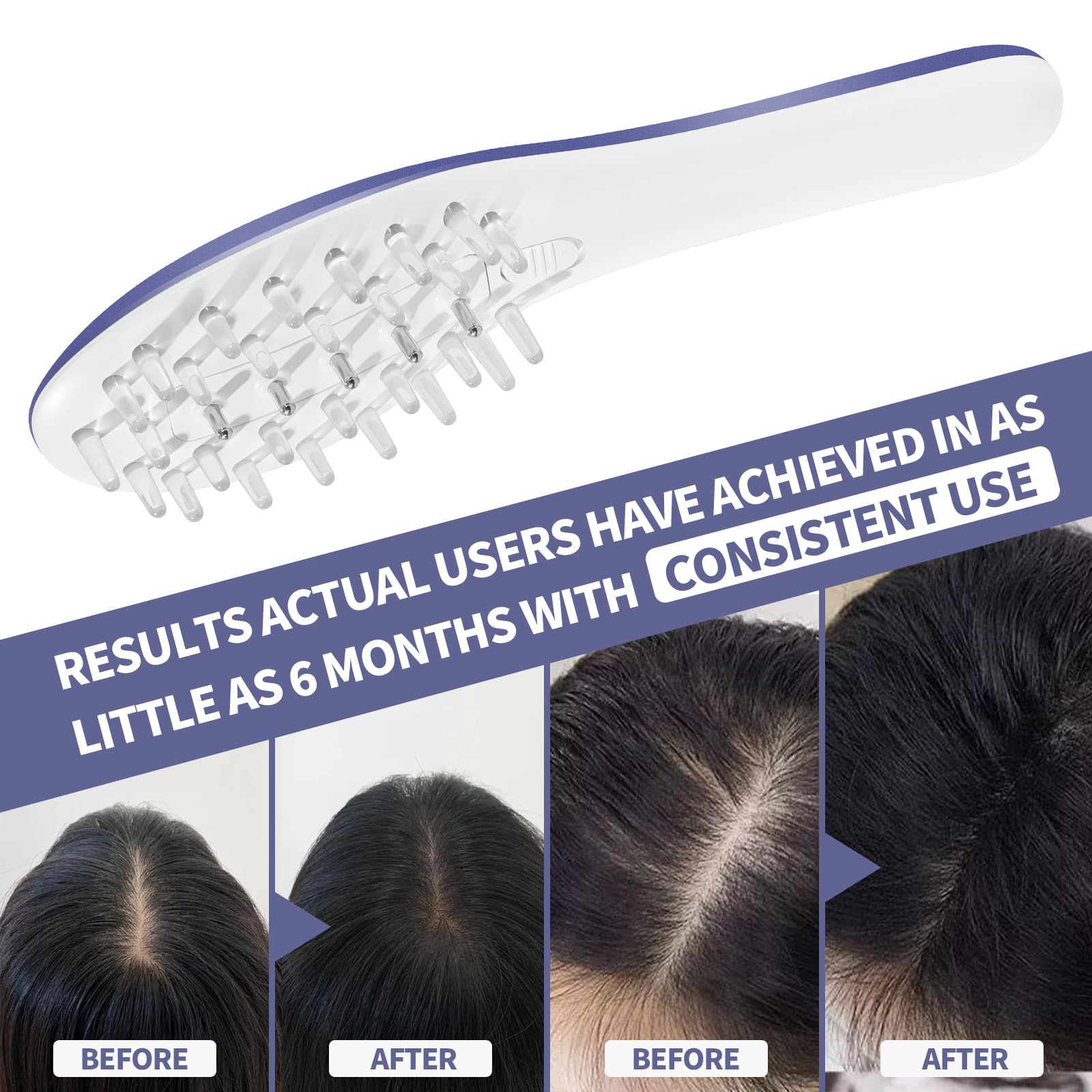 Foto 6 | Peine Para El Crecimiento Del Cabello Con Terapia Láser Nnushk Para Mujeres Y Hombres - Venta Internacional.