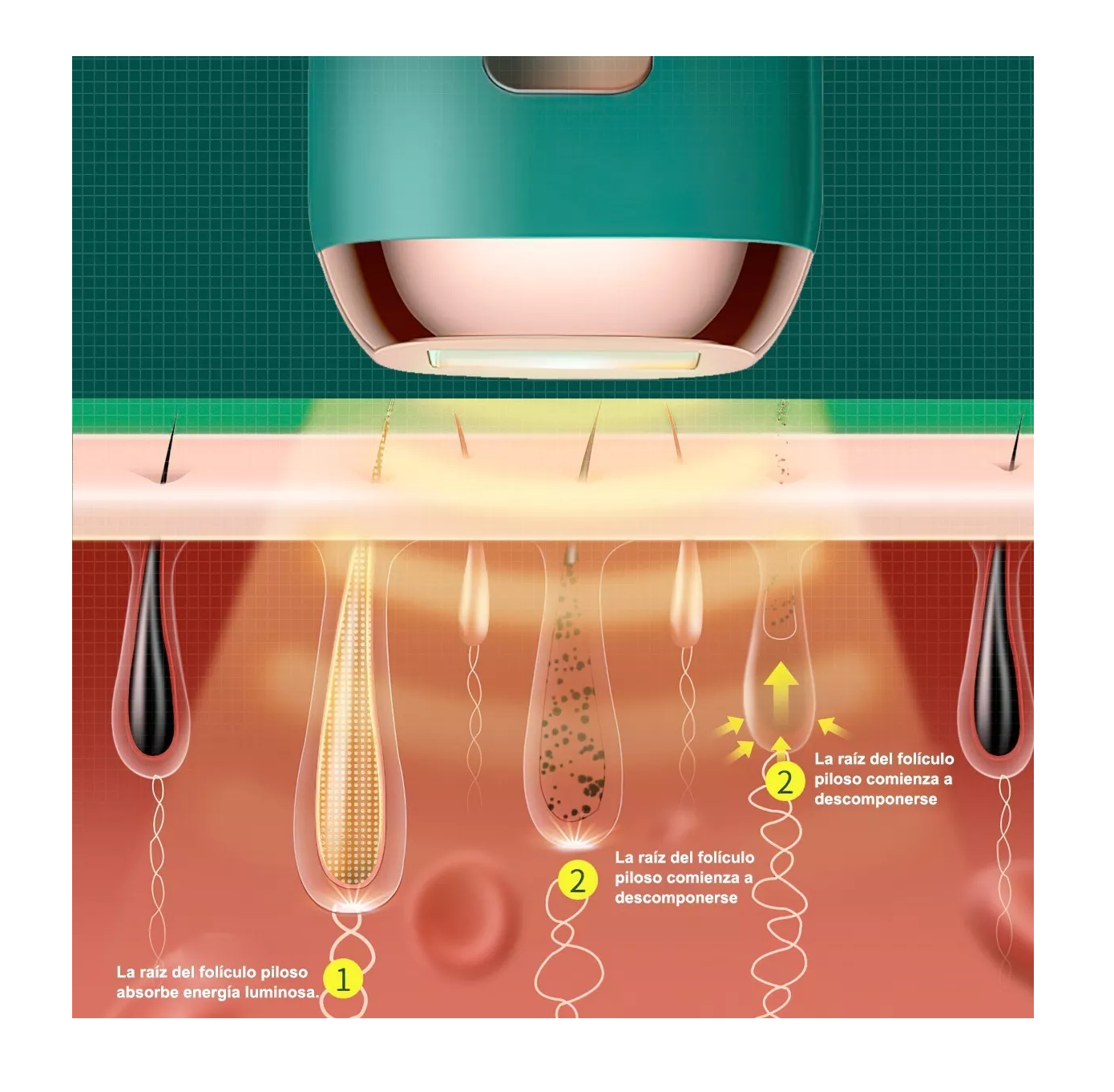 Foto 4 | Depiladora Láser Permanente Lab.G para Cuerpo y Cara